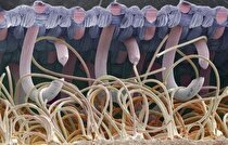 آنالیز تصاویر میکروسکوپی با نرم‌افزار clemex و image j